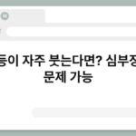 손등이 자주 붓는다면? 심부정맥 문제 가능 6