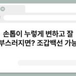 손톱이 누렇게 변하고 잘 부스러지면? 조갑백선 가능 4